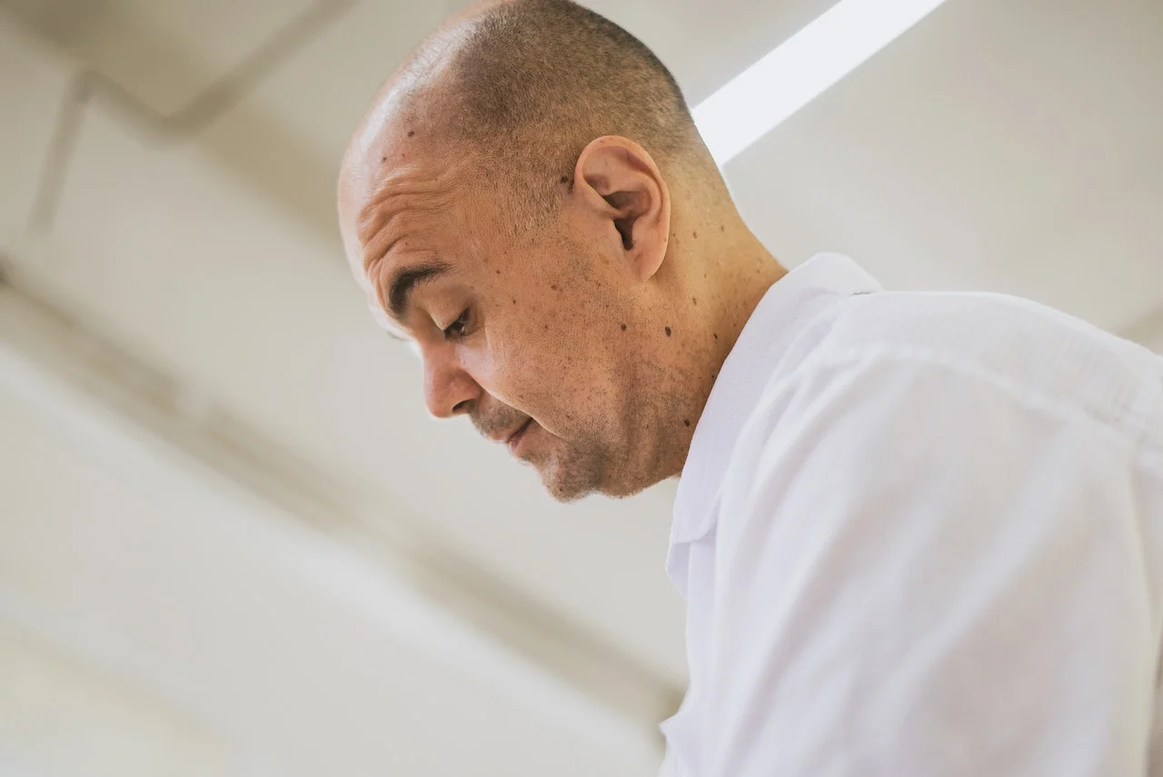 How To Treat Male Pattern Baldness