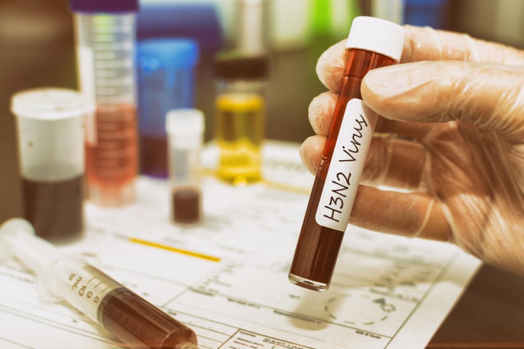 The H3N2 virus is a subtype of influenza “A” virus and it’s currently creating a cause of concern over the globe. Influenza viruses have different categories, i.e. A, B and C, and among them A-type viruses have the most significant and dangerous diseases. In the year 1968, this virus caused a flu pandemic and the death count was above 1 million around the world. Along with humans, the type A virus can also impact other species like birds and animals. According to the Indian Council of Medical Research (ICMR), 79% of the people suffering from influenza, have H3N2 disease. What are the Symptoms? The H3N2 virus has similar symptoms to any other flu. Cough, fever, body ache, headache, sore throat, runny nose, extreme fatigue. Nausea, vomiting and diarrhoea. Vulnerable groups and treatments According to the Indian Medical Association (IMA), this virus will have a serious impact on children below 15 and adults above 50 years. People having co-morbidities like asthma, diabetes and heart disease will have severe implications, and people with weakened immune systems and neurological disorders are also at high risk. There are several medications regarding this particular virus (Peramivir and baloxavir) but People are requested to consult the doctor if they have the above-mentioned symptoms and not to take any kind of medication without consulting the doctor also people are expected to wear a mask in public places. On the other hand, there were several meetings held regarding this virus by NITI Aayog and other health-related organizations. experts are claiming that the impact of this virus will get reduced as soon as the temperature will rise, so basically, at the end of march or in the initial week of April the impact of this virus is expected to reduce.