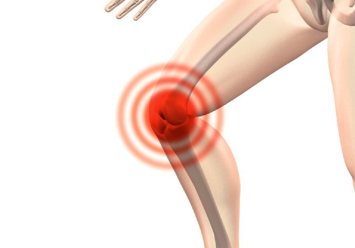 1 billion individuals to get osteoarthritis.