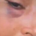 Seema Haider Assaulted: Viral Video Shows Bruised Lip and Eye – What Happened?